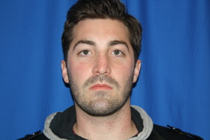 Rhinoplasty Front View After Photo, Nose Shape