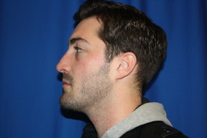 Male Rhinoplasty After Photo, Shape Change Left Side