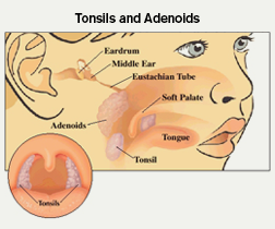 Tonsils and Adenoid