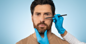 rhinoplasty