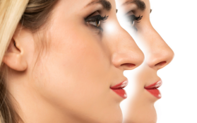 Choosing the Right Path: An In-Depth Look at Different Rhinoplasty Procedures