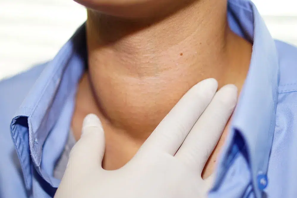 Enlarged thyroid - C/V ENT Surgical Group