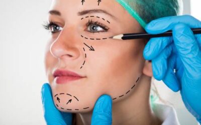 What Is a Minimally Invasive Facelift and How Long Is the Recovery Time?