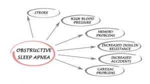 Obstructive sleep apnea health concerns