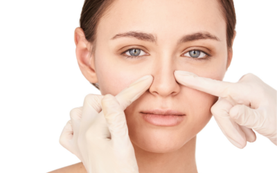 Restoring Confidence: How Rhinoplasty Addresses 8 Common Nose Imperfections