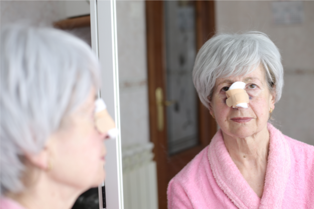 Ageless Beauty: What Can Rhinoplasty Accomplish for Older Patients?