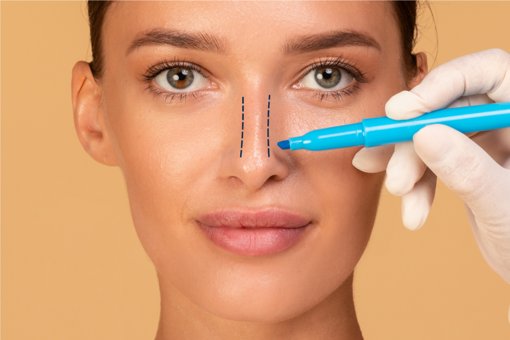 From Consultation to Recovery: 20 Rhinoplasty Questions to Keep in Mind