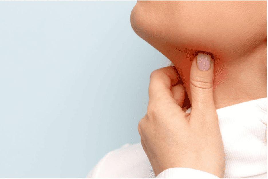 A close-up of a person scratching her neck AI-generated content may be incorrect (1) Person with sore throat and neck discomfort illustrating tonsillitis or peritonsillar abscess symptoms at C/V ENT Surgical Group